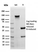 SDS-PAGE analysis of purified, BSA-free S100B/Brain Injury Biomarker antibody (clone S100B/4152) as confirmation of integrity and purity.