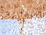 Immunohistochemistry analysis of S100B / Astrocyte Marker antibody (clone S100B/4159) in human brain tissue. FFPE human brain demonstrates strong cytoplasmic and nuclear HRP-DAB brown staining in astrocyte-like cells distributed throughout the parenchyma, consistent with S100B expression. Staining highlights cells with branching morphology characteristic of astroglial cells, while neuronal cell bodies show comparatively weaker signal. Nuclei are counterstained blue. The inset image represents a secondary antibody negative control in which PBS was used in place of the primary antibody and shows absence of specific staining.