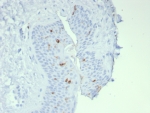 IHC staining of FFPE human skin tissue with Langerin antibody (clone LGRN/7541). HIER: boil tissue sections in pH 9 10mM Tris with 1mM EDTA for 20 min and allow to cool before testing.