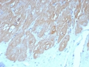 FABP3 Antibody Myocardium IHC. Immunohistochemistry staining of FFPE human heart tissue with FABP3 antibody (clone FABP3/8440). HIER: boil tissue sections in pH 9 10mM Tris with 1mM EDTA for 20 min and allow to cool before testing.