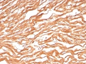 FABP3 Antibody Cardiac Tissue IHC. Immunohistochemistry staining of FFPE human heart tissue with FABP3 antibody (clone FABP3/8443). HIER: boil tissue sections in pH 9 10mM Tris with 1mM EDTA for 20 min and allow to cool before testing.
