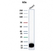 H-FABP Antibody Heart WB. Western blot testing of different lots of human heart lysate with H-FABP antibody. Predicted molecular weight ~14 kDa.