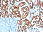 Cardiac Fatty Acid Binding Protein Antibody Heart IHC. Immunohistochemistry staining of FFPE human heart tissue with Cardiac Fatty Acid Binding Protein antibody (clone FABP3/8535R). HIER: boil tissue sections in pH 9 10mM Tris with 1mM EDTA for 20 min and allow to cool before testing.