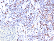 CD8A Antibody LN IHC. Immunohistochemistry analysis of CD8 alpha (CD8A) in FFPE human lymph node tissue shows membranous staining of cytotoxic T lymphocytes distributed throughout lymphoid regions, consistent with CD8-positive cells participating in antigen-driven activation and supporting detection of this T cell activation marker within the immune microenvironment. Inset: PBS used in place of primary antibody as a negative control. Heat-induced epitope retrieval was performed in pH 9 10 mM Tris with 1 mM EDTA for 20 minutes followed by cooling prior to antibody incubation.