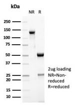 SDS-PAGE analysis of purified, BSA-free MSH6 antibody rabbit monoclonal (clone MSH6/7064R) as confirmation of integrity and purity.