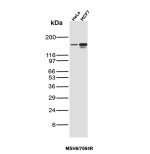 MSH6 Antibody Recombinant Rabbit MAb MSH6/7064R in HeLa and MCF7 Cancer Cells WB. Western blot testing of MSH6 Antibody Recombinant Rabbit MAb MSH6/7064R / GTBP in human HeLa cervical cancer and MCF7 breast cancer cell lysates. A prominent band is detected at approximately 160 kDa in both samples, consistent with the predicted molecular weight of MSH6. This MSH6 Antibody demonstrates detection of GTBP/MSH6 in multiple human cancer cell lines.
