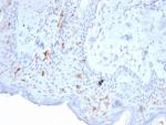 IHC staining of FFPE human skin tissue with Langerin antibody (clone LGRN/7356). HIER: boil tissue sections in pH 9 10mM Tris with 1mM EDTA for 20 min and allow to cool before testing.
