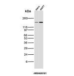 MSH6 Antibody Recombinant Mouse MAb rMSH6/8181 in HeLa and MCF7 Cancer Cells WB. Western blot testing of MSH6 Antibody Recombinant Mouse MAb rMSH6/8181 in human HeLa cervical cancer and MCF7 breast cancer cell lysates. A prominent band is detected at approximately 160 kDa in both samples, consistent with the predicted molecular weight of MSH6. This MSH6 Antibody demonstrates detection of the DNA mismatch repair protein in multiple human cancer cell lines.
