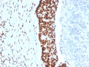 MutS homolog 2 Antibody (clone MSH2/3165) / MSH2 Antibody. Immunohistochemistry analysis of FFPE human colon tissue using MutS homolog 2 antibody (clone MSH2/3165). Strong nuclear brown chromogenic staining highlights MutS homolog 2 / MSH2-positive epithelial cells within the colonic mucosa, consistent with the expected nuclear localization of this DNA mismatch repair protein. Heat-induced epitope retrieval was performed by boiling tissue sections in pH 9 10mM Tris with 1mM EDTA for 20 minutes followed by cooling prior to staining.
