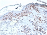 XRCC5 Antibody Human Skin Tissue IHC. Immunohistochemistry analysis of human skin tissue using XRCC5 antibody clone XRCC5/7314. Formalin-fixed, paraffin-embedded sections show strong HRP-DAB brown nuclear staining in epidermal keratinocytes, with comparatively weaker staining in the dermal compartment. The nuclear localization is consistent with XRCC5 (Ku80) function in preserving genome integrity, reflecting continuous DNA repair activity in proliferative epithelial layers exposed to environmental stress. The inset shows PBS used in place of primary antibody (secondary antibody negative control), demonstrating absence of specific staining. Hematoxylin counterstain highlights nuclei (blue), providing contrast to the XRCC5-positive nuclear staining pattern.