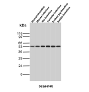 Desmin Antibody Multi-Species Intestine WB. Western blot analysis of intestine tissue lysates from human, mouse, rat, hamster, guinea pig, and rabbit using Desmin Antibody (clone DES/8610R) detects a band at approximately 53 kDa across all species, consistent with the expected molecular weight of Desmin. The conserved banding pattern supports reliable cross-species detection of this muscle-associated intermediate filament protein, reflecting its expression in smooth muscle components of intestinal tissue.