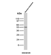 Desmin Antibody Human Intestine WB. Western blot analysis of human intestine tissue lysate using Desmin Antibody (clone DES/8610R) detects a band at approximately 53 kDa, consistent with the expected molecular weight of Desmin. The observed signal supports detection of this muscle-associated intermediate filament protein, reflecting its expression in smooth muscle components of intestinal tissue.