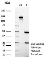 SDS-PAGE analysis of purified, BSA-free Villin Antibody / Gastrointestinal Epithelial Marker Antibody (clone VIL1/8105R) as confirmation of integrity and purity.