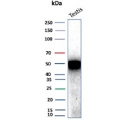 Inhibin alpha Antibody Recombinant Rabbit MAb (clone INHA/8872R) western blot analysis. Western blot testing of human testis tissue lysate using Inhibin alpha Antibody Recombinant Rabbit MAb (clone INHA/8872R). A band is detected at approximately 40 kDa, consistent with the predicted molecular weight of Inhibin subunit alpha (INHA). A slightly higher apparent molecular weight band may be observed due to glycosylation of the inhibin alpha protein.