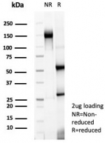 SDS-PAGE analysis of purified, BSA-free Nucleolin Antibody Recombinant Rabbit mAb NCL/8068R as confirmation of integrity and purity.