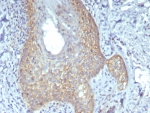 CTNNB1 Stability Regulation Antibody Skin Tissue IHC. Immunohistochemistry analysis of FFPE human skin tissue using CTNNB1 Antibody (clone rCTNNB1/8043) shows prominent membranous staining in epithelial cell layers with additional cytoplasmic signal, consistent with Catenin beta-1 localization at adherens junctions and regulated intracellular pools. This distribution reflects controlled beta-catenin stability within stratified epithelial structures. Tissue architecture is well preserved, and surrounding stromal components display comparatively low staining. Hematoxylin counterstain provides nuclear contrast and structural context. HIER: boil FFPE tissue sections in pH 9 10 mM Tris with 1 mM EDTA for 20 min and allow to cool before testing.