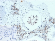 HGAL Antibody Testis IHC. Immunohistochemistry analysis of FFPE human testis tissue stained with HGAL Antibody demonstrates cytoplasmic and focal nuclear HRP-DAB brown staining within scattered germinal center-associated lymphoid cells and immune-associated cellular populations. This germinal center B-cell marker antibody highlights HGAL / GCSAM-associated immune differentiation pathways and lymphoma-related germinal center signaling biology. Inset: PBS used in place of primary antibody demonstrates minimal background staining in the secondary antibody negative control. HIER: boil tissue sections in pH 9 10mM Tris with 1mM EDTA for 20 min and allow to cool before testing.