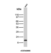 CSTA Antibody A431 WB. Western blot analysis of Cystatin A / CSTA in human A431 cell lysate using recombinant rabbit monoclonal CSTA antibody, clone rCSTA/8995. A band is detected at approximately 11 kDa, consistent with the predicted molecular weight of CSTA, supporting detection of this intracellular cysteine protease inhibitor in epithelial-derived cells.
