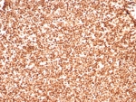 Histone H1 Antibody for IHC. Immunohistochemistry analysis of chromatin boundary-associated histone H1 expression in FFPE human lymph node tissue using Histone H1 Antibody. Nuclear HRP-DAB brown staining is observed in lymphoid cells, consistent with localization of linker histone H1 within chromatin domains and its role in chromatin boundary formation and domain insulation. Clone rHH1/8702 antibody demonstrates strong nuclear compartmentalization with minimal cytoplasmic staining, reflecting chromatin-associated distribution across organized chromatin domains.