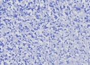Negative control: IHC testing of FFPE human brain tissue with CD10 antibody (clone MME/8376R) at 2ug/ml. HIER: boil tissue sections in pH 9 10mM Tris with 1mM EDTA for 20 min and allow to cool before testing.