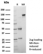 SDS-PAGE analysis of purified, BSA-free PSAP Antibody Recombinant Rabbit MAb ACPP/8409R as confirmation of integrity and purity.