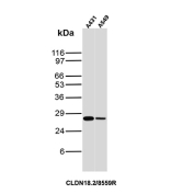 Claudin18.2 Antibody A431 and A549 WB. Western blot analysis of human A431 and A549 cell lysates using Claudin18.2 Antibody / Gastrointestinal Cancer Marker clone CLDN18.2/8559R. A distinct band is detected at approximately 27-28 kDa, consistent with the predicted molecular weight of Claudin18.2, a tight junction-associated transmembrane protein implicated in gastric and pancreatic cancer biology.