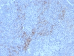 IHC staining of FFPE human lymph node tissue with CD10 antibody (clone rMME/8584). HIER: boil tissue sections in pH 9 10mM Tris with 1mM EDTA for 20 min and allow to cool before testing.