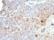 Somatostatin Antibody / Neuronostatin (clone SST/7200R) IHC. Immunohistochemistry of FFPE human pancreas tissue using Somatostatin antibody clone SST/7200R, a recombinant rabbit monoclonal antibody recognizing the somatostatin precursor peptide encoded by SST. HRP-DAB brown cytoplasmic staining is observed in scattered endocrine cells within pancreatic islets, consistent with somatostatin-producing delta cells, while surrounding exocrine acinar cells show minimal staining. Nuclei appear blue from hematoxylin counterstain. Tissue sections were subjected to heat-induced epitope retrieval by boiling in pH 9 Tris-EDTA buffer (10mM Tris with 1mM EDTA) for 20 minutes followed by cooling prior to staining.