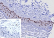 TP63 Antibody Skin IHC. Immunohistochemistry analysis of Tumor protein 63 (TP63) in FFPE human skin tissue using a TP63 antibody as an epithelial stem cell marker (clone TP63/7807R) demonstrates strong HRP-DAB brown nuclear staining in basal keratinocytes along the epidermal basal layer. The staining is confined to progenitor cell populations at the dermal-epidermal junction, while suprabasal differentiated keratinocytes show reduced or absent signal, consistent with the role of TP63 in maintaining epithelial stem and progenitor cell compartments. The nuclear localization clearly outlines the basal layer and highlights epidermal organization and stratification. Inset: PBS was used in place of the primary antibody as a negative control, showing no brown signal. Heat-induced epitope retrieval was performed by boiling tissue sections in pH 9 10mM Tris with 1mM EDTA for 20 minutes followed by cooling prior to antibody incubation.