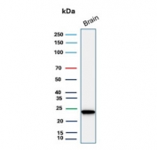 UCHL1 Antibody for WB. Western blot analysis in human brain lysate. Human brain tissue lysate stained with UCHL1 Antibody for WB, also known as Cancer Cell Western Blot Antibody and Ubiquitin C-terminal hydrolase L1 antibody, shows a distinct band at approximately 25 kDa, consistent with the predicted molecular weight of UCHL1 / PGP9.5. The clear band supports its use for detecting UCHL1 in tumor-related western blot workflows, including comparative analysis of cancer cell lysates and evaluation of tumor-associated protein expression.
