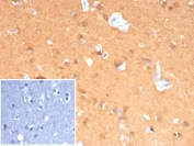 IHC staining of FFPE human cerebellum tissue with UCHL1 antibody (clone rUCHL1/8133). Inset: PBS used in place of primary Ab (secondary Ab negative control). HIER: boil tissue sections in pH 9 10mM Tris with 1mM EDTA for 20 min and allow to cool before testing.