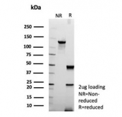 SDS-PAGE analysis of purified, BSA-free UCHL1 Antibody / Cancer Cell Western Blot Antibody (clone rUCHL1/8133) as confirmation of integrity and purity.