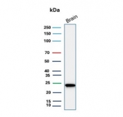 PGP9.5 Antibody for WB. Western blot analysis in human brain lysate. Human brain tissue lysate stained with PGP9.5 Antibody for WB, also known as Neuronal Marker Western Blot Antibody and Ubiquitin C-terminal hydrolase L1 antibody, shows a strong band at approximately 25 kDa, consistent with the predicted molecular weight of PGP9.5 / UCHL1. The intense signal in brain tissue aligns with the well-established neuronal enrichment of this protein, supporting its use as a reliable marker for neuronal protein expression in western blot applications.