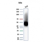 CD38 Antibody human Raji lysate WB. Western blot analysis of CD38 expression in human Raji cell lysate using CD38 antibody clone rCD38/8045. Lane 1: human Raji cell lysate. A band is detected at approximately 40-45 kDa, consistent with the predicted molecular weight of CD38, with higher apparent molecular weight reflecting glycosylation of this cell surface protein. The detection profile supports its role in calcium-dependent signaling pathways and intracellular signal transduction in immune cells.
