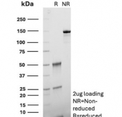 SDS-PAGE analysis of purified, BSA-free CD38 antibody (clone rCD38/8334) as confirmation of integrity and purity.