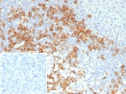 CD38 Antibody human tonsil tissue IHC. Immunohistochemistry analysis of CD38 expression in FFPE human tonsil tissue using CD38 antibody clone CD38/8114R. Strong membranous HRP-DAB brown staining highlights lymphocyte populations within interfollicular regions and surrounding germinal centers, consistent with cell surface localization of this ectoenzyme on immune cells. The staining pattern demonstrates prominent membrane-associated signal with minimal background in surrounding lymphocytes. Inset: PBS was used in place of the primary antibody as a secondary antibody negative control. HIER was performed by boiling tissue sections in pH 9 10 mM Tris with 1 mM EDTA for 20 minutes followed by cooling prior to antibody incubation.
