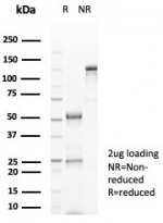 SDS-PAGE analysis of purified, BSA-free CD38 Antibody for WB / CD38 Western Blot Antibody (clone CD38/8075R) as confirmation of integrity and purity.