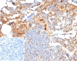 MIG9 Antibody / Migration Inducing Gene 9 Antibody (clone S100P/7374) in human tonsil tissue. Immunohistochemistry staining of FFPE human tonsil demonstrates cytoplasmic staining in scattered epithelial and inflammatory cells consistent with expression of S100 calcium binding protein P / S100P, also known as migration inducing gene 9 (MIG9). Brown chromogenic signal highlights MIG9-positive cells within the tonsillar tissue while surrounding lymphoid populations show comparatively weaker staining. The inset shows PBS used in place of primary antibody as a secondary-only negative control. Heat-induced epitope retrieval was performed by boiling tissue sections in pH 9 Tris buffer with 1 mM EDTA for 20 min before staining.