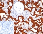 Migration Inducing Gene 9 Antibody / S100P Antibody (clone S100P/7375) in human placental tissue. Immunohistochemistry staining of FFPE human placenta demonstrates strong cytoplasmic staining in trophoblastic epithelial cells consistent with the known epithelial expression pattern of S100 calcium binding protein P / S100P, also referred to as migration inducing gene 9 (MIG-9). Brown chromogenic signal highlights S100P-positive trophoblast layers while surrounding stromal elements show comparatively weaker staining. The inset shows PBS used in place of primary antibody as a secondary-only negative control. Heat-induced epitope retrieval was performed by boiling tissue sections in pH 9 Tris buffer with 1 mM EDTA for 20 min before staining.