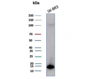 S100P Antibody for WB / MIG9 Antibody for Western Blotting (clone S100P/7373). Western blot analysis of human SK-BR-3 cell lysate demonstrates detection of S100 Calcium Binding Protein P / MIG9 using S100P Antibody for WB. A band is detected at approximately 10 kDa, consistent with the predicted molecular weight of S100P. Lane 1: human SK-BR-3 whole cell lysate.