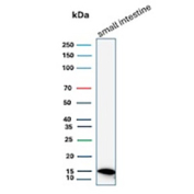 I-FABP Antibody Small Intestine WB. Western blot analysis of human small intestine tissue lysate using I-FABP antibody clone FABP2/7670. A band is detected at approximately 15 kDa, consistent with the predicted molecular weight of Intestinal fatty acid-binding protein / FABP2, a cytoplasmic lipid transport protein enriched in intestinal epithelial cells.