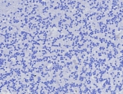 Negative control: IHC testing of FFPE human brain tissue with AMACR antibody (clone AMACR/8350R) at 2ug/ml. HIER: boil tissue sections in pH 9 10mM Tris with 1mM EDTA for 20 min and allow to cool before testing.