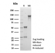 SDS-PAGE analysis of purified, BSA-free AMACR antibody (clone AMACR/8350R) as confirmation of integrity and purity.