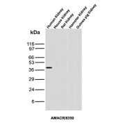 AMACR Antibody Kidney Tissue WB. Western blot analysis of human, mouse, rat, hamster, and guinea pig kidney tissue lysates using AMACR / p504S Antibody clone AMACR/8350R demonstrates a distinct band at approximately 40-42 kDa selectively in human kidney lysate, consistent with the predicted molecular weight of Alpha-methylacyl-CoA racemase / AMACR. The restricted cross-species reactivity pattern suggests preferential recognition of the human AMACR epitope by clone AMACR/8350R.