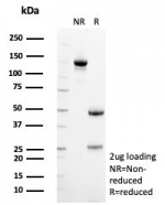 SDS-PAGE analysis of purified, BSA-free SDHA antibody (clone SDHA/7492) as confirmation of integrity and purity.