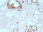 Immunohistochemistry of OCLN antibody in human kidney tissue. The recombinant mouse mAb clone rOCLN/8776 demonstrates membranous HRP-DAB brown staining along renal tubular epithelial cell borders, consistent with tight junction localization of Occludin. Signal is concentrated at apical lateral cell-cell junctions within tubular structures, while surrounding interstitial tissue shows minimal background staining. Heat-induced epitope retrieval was performed by boiling tissue sections in pH 9 10mM Tris with 1mM EDTA for 20 minutes followed by cooling prior to incubation.