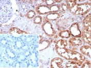 Immunohistochemistry of Occludin antibody in human kidney tissue. The recombinant rabbit mAb clone OCLN/8526R demonstrates membranous HRP-DAB brown staining predominantly along renal tubular epithelial cell borders, consistent with tight junction localization of Occludin. Staining highlights apical lateral cell-cell junctions within tubular structures, while surrounding interstitial areas show minimal background signal. The negative control inset, using PBS in place of the primary antibody, shows no specific staining. Heat-induced epitope retrieval was performed by boiling tissue sections in pH 9 10mM Tris with 1mM EDTA for 20 minutes followed by cooling prior to incubation.