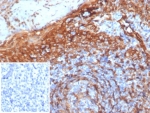 STING1 Antibody Clone STING1/7441 immunohistochemistry analysis of human tissue. IHC staining of formalin-fixed, paraffin-embedded human tonsil using STING1 Antibody Clone STING1/7441 demonstrates HRP-DAB brown cytoplasmic staining in numerous lymphoid immune cells within tonsillar tissue, consistent with expression of Stimulator of interferon genes protein / STING1 (TMEM173) in antigen-presenting cell populations. Heat-induced epitope retrieval was performed by boiling tissue sections in pH 9 10 mM Tris with 1 mM EDTA for 20 min followed by cooling prior to antibody incubation. The inset shows PBS used in place of the primary antibody as a negative control.