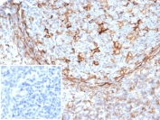 STING1 Antibody Clone STING1/7433 immunohistochemistry analysis of human tissue. IHC staining of formalin-fixed, paraffin-embedded human tonsil using STING1 Antibody Clone STING1/7433 shows HRP-DAB brown cytoplasmic staining in numerous lymphoid immune cells, consistent with expression of Stimulator of interferon genes protein / STING1 (TMEM173) in antigen-presenting cell populations within tonsillar tissue. Heat-induced epitope retrieval was performed by boiling tissue sections in pH 9 10 mM Tris with 1 mM EDTA for 20 min followed by cooling prior to antibody incubation. The inset shows PBS used in place of the primary antibody as a negative control.