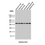 Vascular Endothelial Growth Factor Antibody Multi-Species WB. Western blot analysis of lung tissue lysates from multiple species using Vascular Endothelial Growth Factor Antibody / VEGF (clone VEGFA/7757R). Lane 1: human lung, Lane 2: mouse lung, Lane 3: rat lung, Lane 4: hamster lung, Lane 5: guinea pig lung, Lane 6: rabbit lung tissue lysate. An HRP-conjugated secondary antibody with ECL substrate was used for detection. This recombinant rabbit monoclonal Vascular Endothelial Growth Factor Antibody detects VEGFA expression across multiple species, supporting studies of angiogenesis, endothelial signaling, vascular development, and VEGF-mediated tissue remodeling pathways.